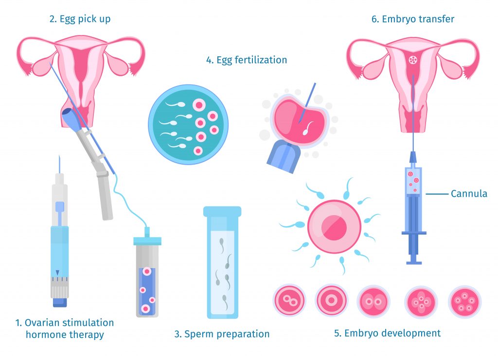 IVF คออะไร มขนตอนอยางไร ขอด ขอจำกด ราคาเทาไหร