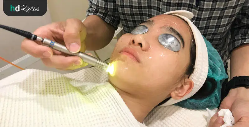 รีวิว Dual Yellow Laser เพิ่มความกระจ่างใส ลดรอยสิว