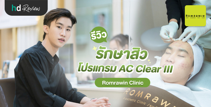 รีวิว รักษาสิว โปรแกรม AC Clear III ที่ Romrawin Clinic