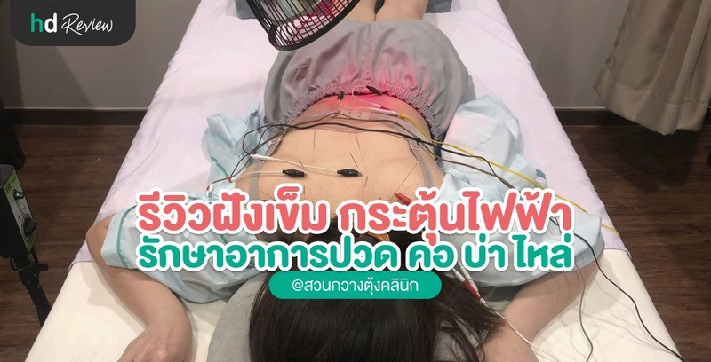 รีวิวฝังเข็มกระตุ้นไฟฟ้า แก้ออฟฟิศซินโดรม ที่ สวนกวางตุ้งคลินิก 9 รีวิวฝังเข็มกระตุ้นไฟฟ้า แก้ออฟฟิศซินโดรม ที่ สวนกวางตุ้งคลินิก