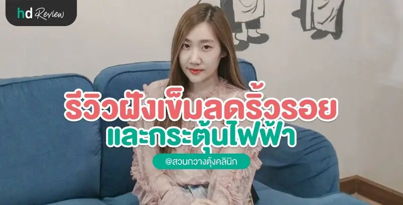 รีวิวฝังเข็มลดริ้วรอยร่องแก้ม และกระตุ้นไฟฟ้า ที่ สวนกวางตุ้ง คลินิก