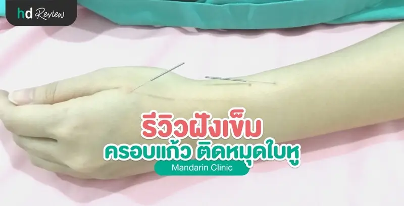 รีวิวทุกขั้นตอน ฝังเข็ม ครอบแก้ว ติดหมุดใบหู ที่ Mandarin Clinic
