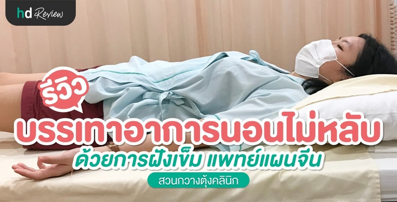 รีวิว ฝังเข็มบรรเทาอาการนอนไม่หลับ ที่ สวนกวางตุ้งคลินิก