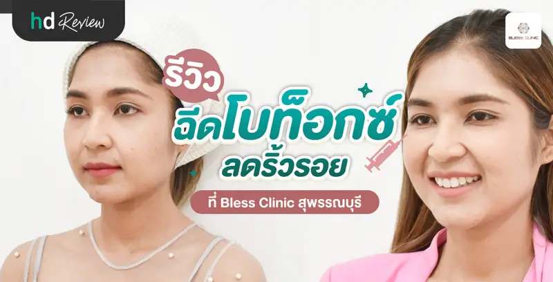 รีวิว ฉีดโบท็อกซ์ลดริ้วรอย ที่ Bless Clinic สุพรรณบุรี
