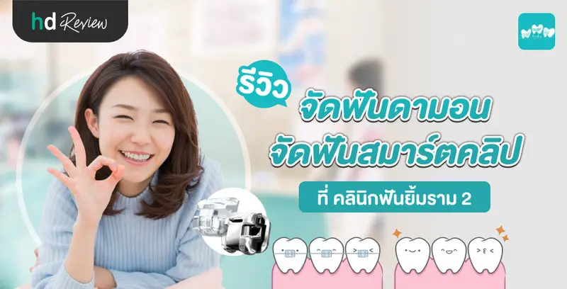 รีวิว จัดฟันดามอน จัดฟันสมาร์ตคลิป ที่ คลินิกฟันยิ้มราม 2