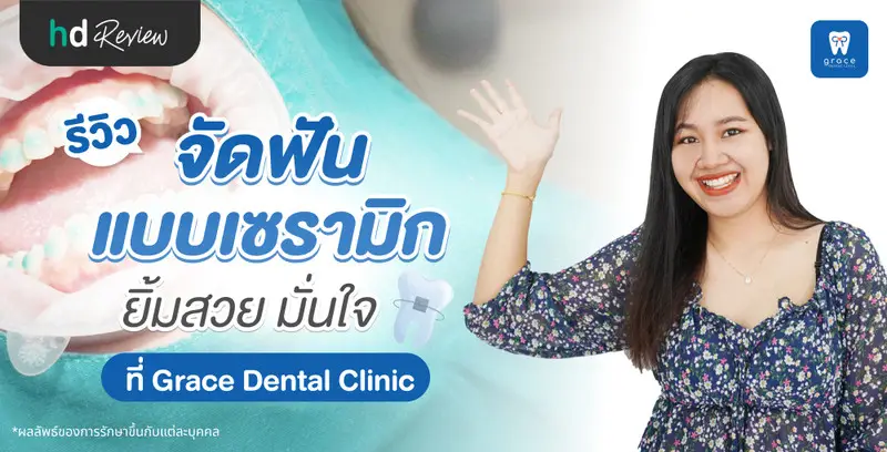 รีวิว จัดฟันแบบเซรามิก ที่ Grace Dental Clinic