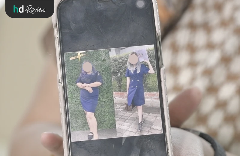 รีวิวใส่บอลลูนในกระเพาะอาหาร ที่ โรงพยาบาลเกษมราษฎร์ รามคำแหง