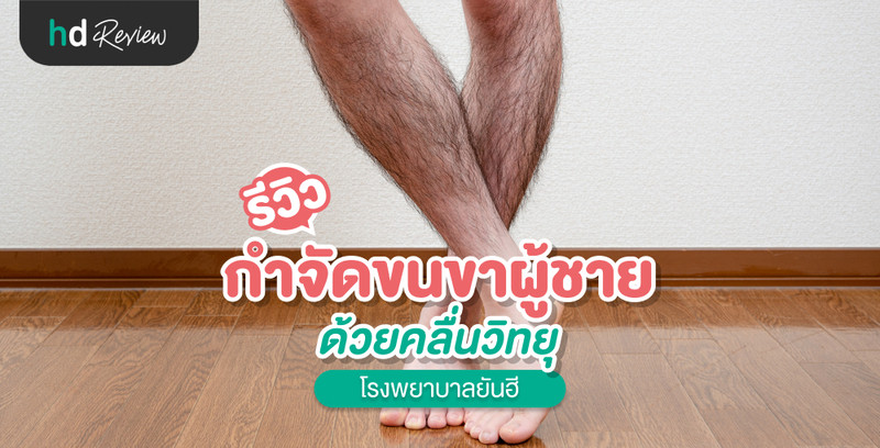 รีวิว กำจัดขนขาผู้ชาย ด้วยคลื่นวิทยุ ที่ โรงพยาบาลยันฮี