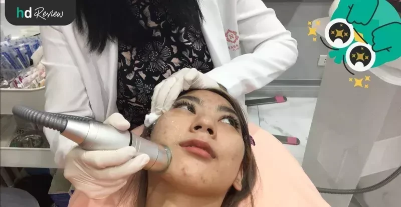 รีวิวทำ Hifu ด้วยเครื่อง New Hifu K Lift ที่ Napassaree Clinic