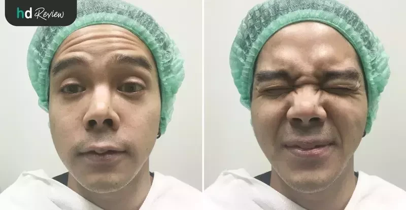 รีวิว ทำ Hifu และฉีดโบฯ ลดริ้วรอย ที่ LV Aesthetic By Dr.Lucy
