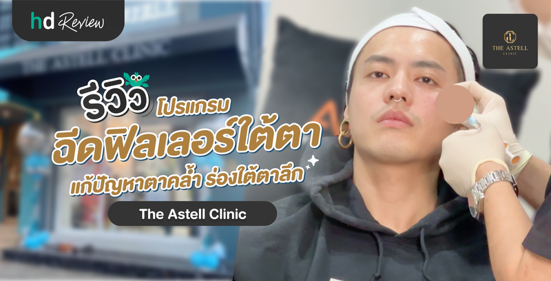 รีวิว โปรแกรมฉีดฟิลเลอร์ใต้ตา แก้ปัญหาตาคล้ำ ร่องใต้ตาลึก ที่ The Astell Clinic