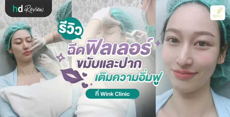 รีวิว ฉีดฟิลเลอร์ขมับและปาก เติมความอิ่มฟู ที่ Wink Clinic