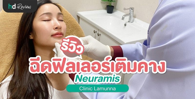 รีวิว ฉีดฟิลเลอร์คาง Neuramis ที่ Clinic Lamunna