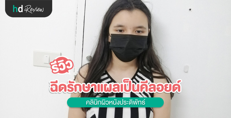 รีวิว ฉีดรักษาแผลเป็นคีลอยด์ ที่ คลินิกผิวหนังประดิพัทธ์