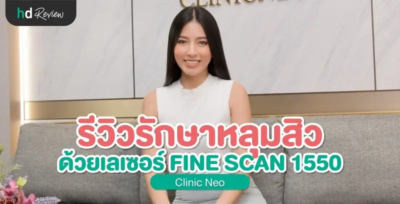 รีวิวรักษาหลุมสิวด้วยเลเซอร์ FINE SCAN 1550 ที่ Clinic Neo