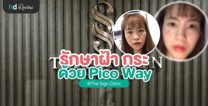 รีวิวเลเซอร์ ฝ้า กระ ด้วย Pico Way ที่ The Sign Clinic