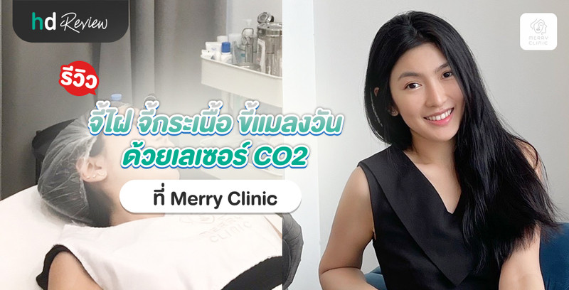 รีวิว จี้ไฝ จี้กระเนื้อ จี้ขี้แมลงวัน ด้วยเลเซอร์ CO2 ที่ Merry Clinic
