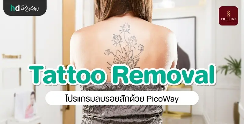 รีวิว PicoWay Tattoo Removal ลบรอยสักที่เดอะไซน์ คลินิก (The Sign Clinic)