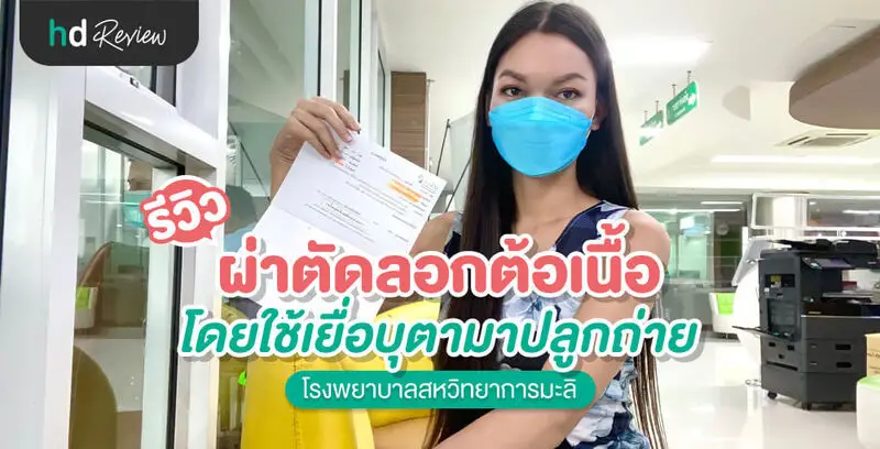 รีวิว ผ่าตัดลอกต้อเนื้อ โดยใช้เยื่อบุตามาปลูกถ่าย ที่ โรงพยาบาลสหวิทยาการมะลิ