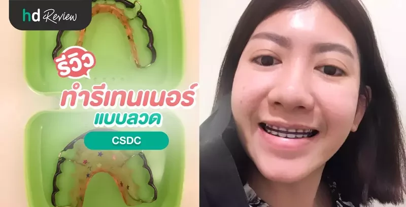 รีวิว ทำรีเทนเนอร์แบบลวด ที่ CSDC จองผ่าน HDmall.co.th