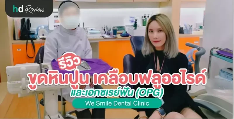 รีวิว ขูดหินปูน เคลือบฟลูออไรด์ และเอกซเรย์ฟัน (OPG) ที่ We Smile Dental Clinic