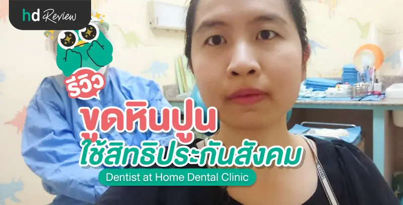 รีวิว ขูดหินปูนสิทธิประกันสังคม พร้อมเคลือบฟลูออไรด์ ที่ Dentist at Home Dental Clinic