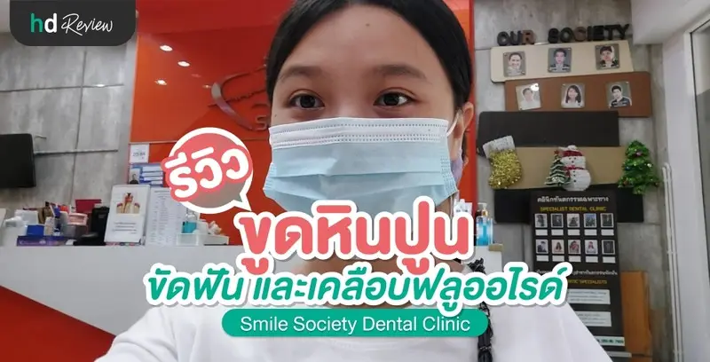 รีวิว ขูดหินปูน ขัดฟัน เคลือบฟลูออไรด์ ที่ คลินิกทันตกรรมสไมล์โซไซตี้