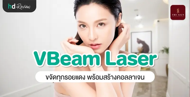 รีวิว Vbeam รักษาสิว สิวอักเสบ รอยแดงสิว รอยเส้นเลือดขยายบนใบหน้า และแก้ปัญหาเส้นเลือดขอดที่เดอะไซน์ คลินิก (The Sign Clinic)