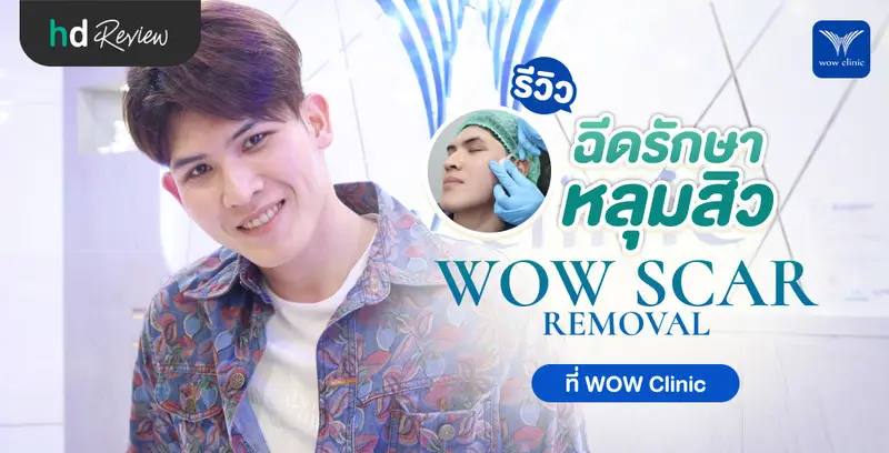 รีวิว ฉีดหลุมสิว WOW Scar Removal ที่ WOW Clinic
