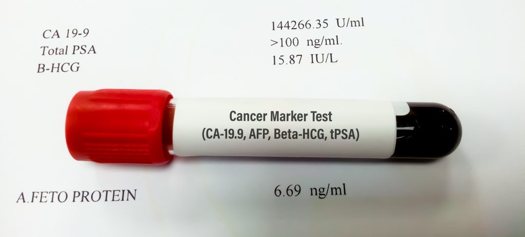 AFP (Alpha-Fetoprotein Tumor Marker) คืออะไร?