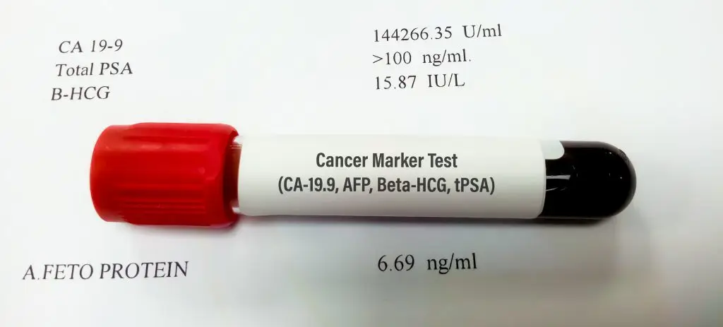 Alpha-Fetoprotein (AFP) Tumor Marker