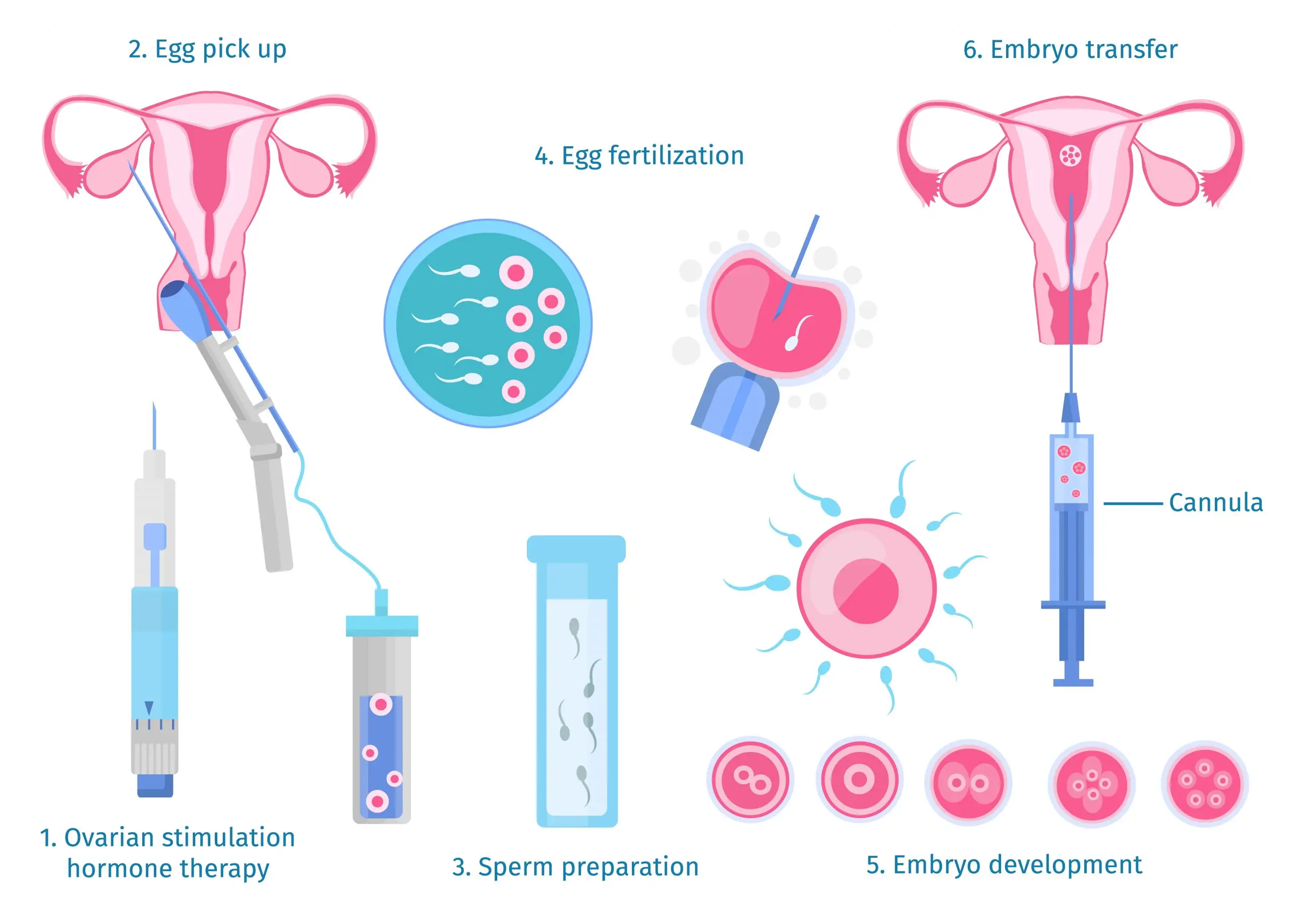 IVF คืออะไร มีขั้นตอนอย่างไร ข้อดี ข้อจำกัด ราคาเท่าไหร่ scaled