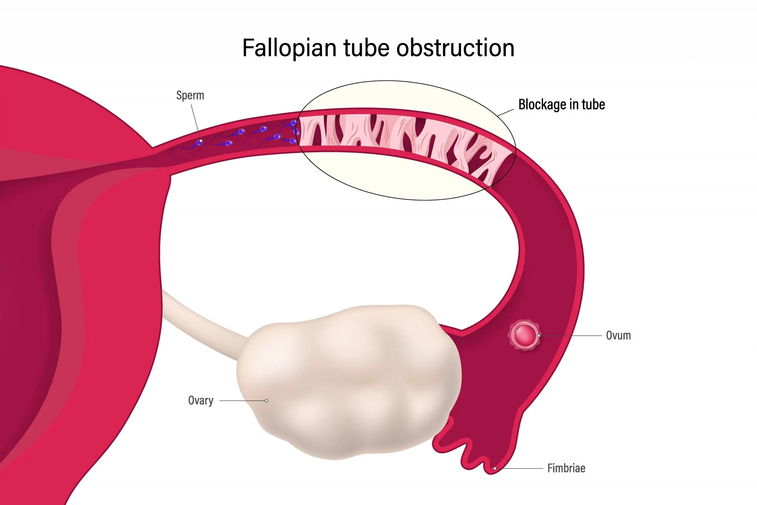 oviduct disease definition scaled