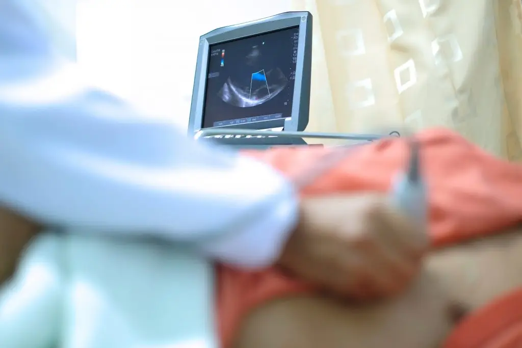 การตรวจเอ็กโคคาร์ดีโอแกรม Echocardiogram