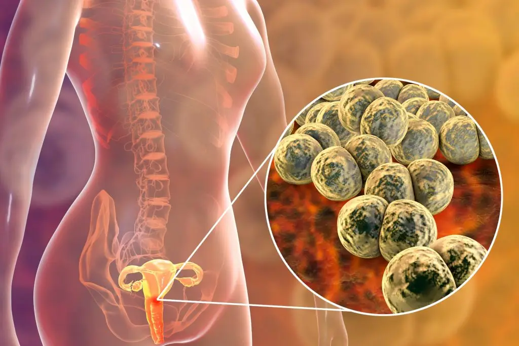 โรคหนองในผู้หญิง หนึ่งในโรคติดต่อทางเพศสัมพันธ์ที่อันตราย