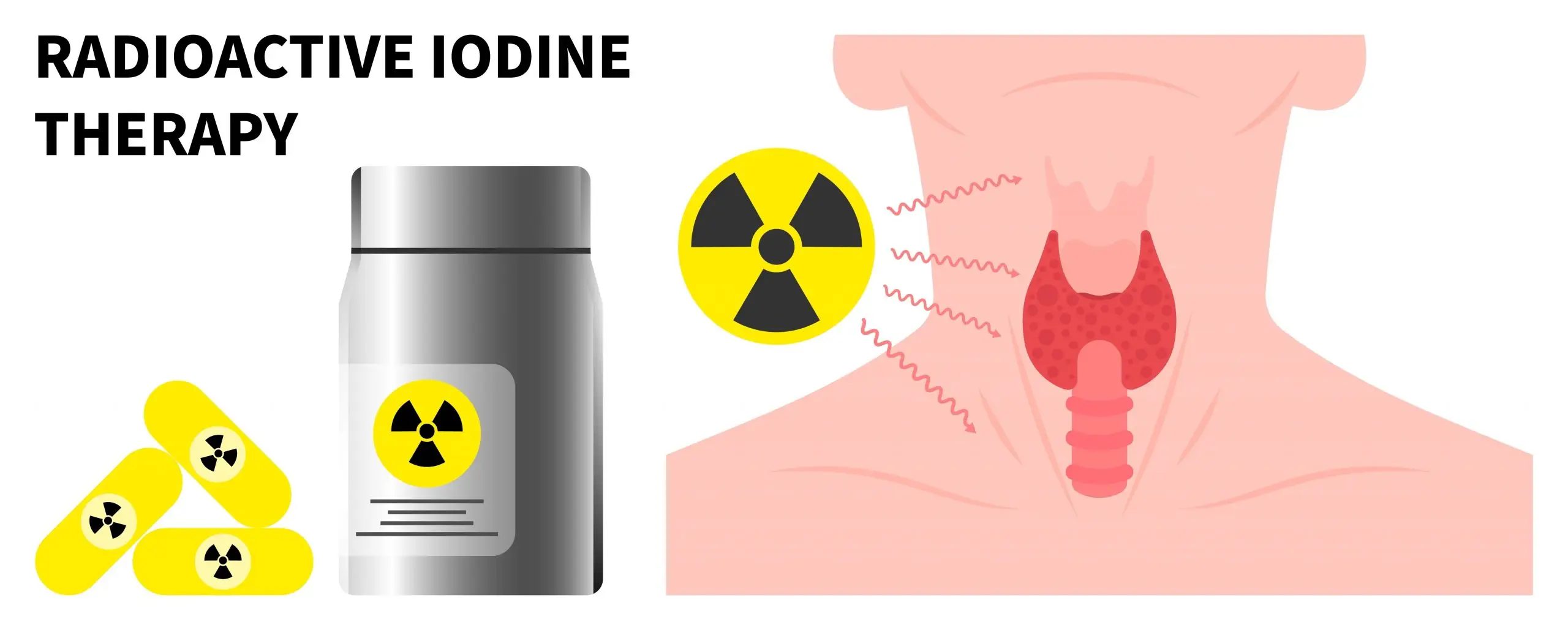 thyroid radioiodine treatment process scaled