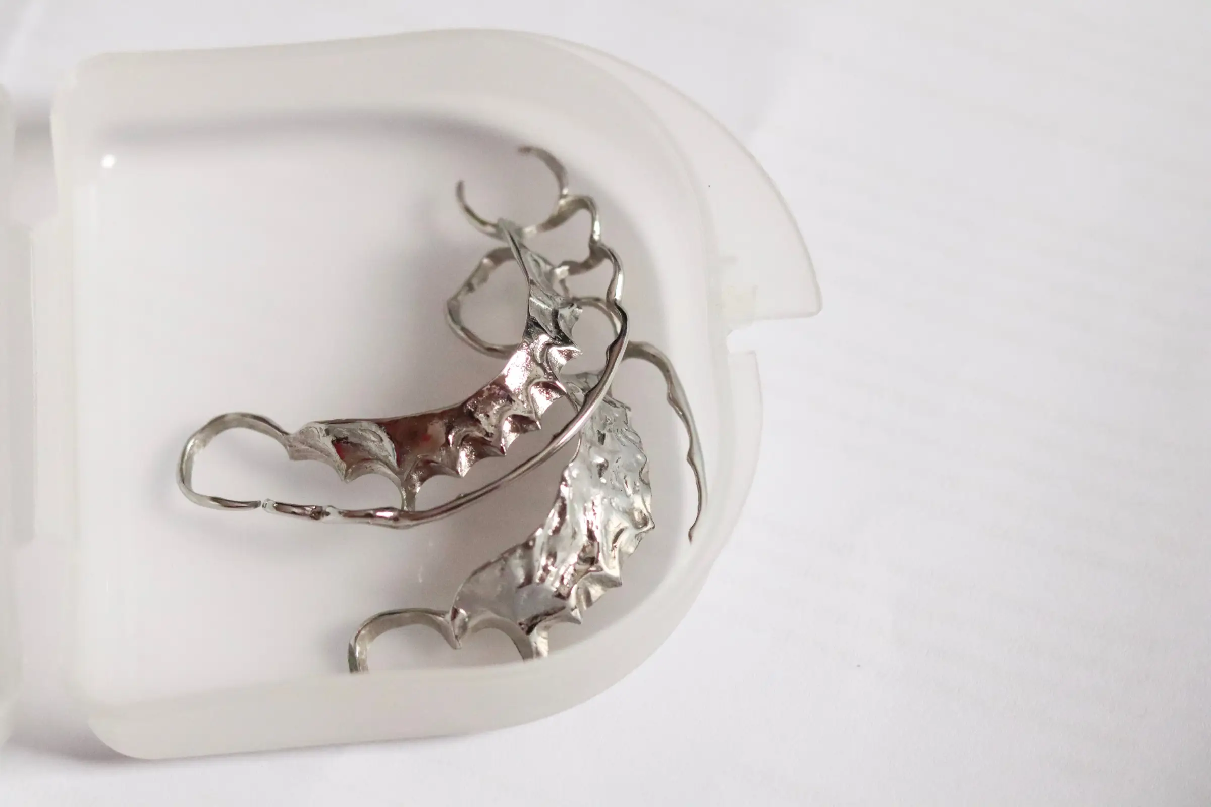 all metal retainers pros cons treatment process