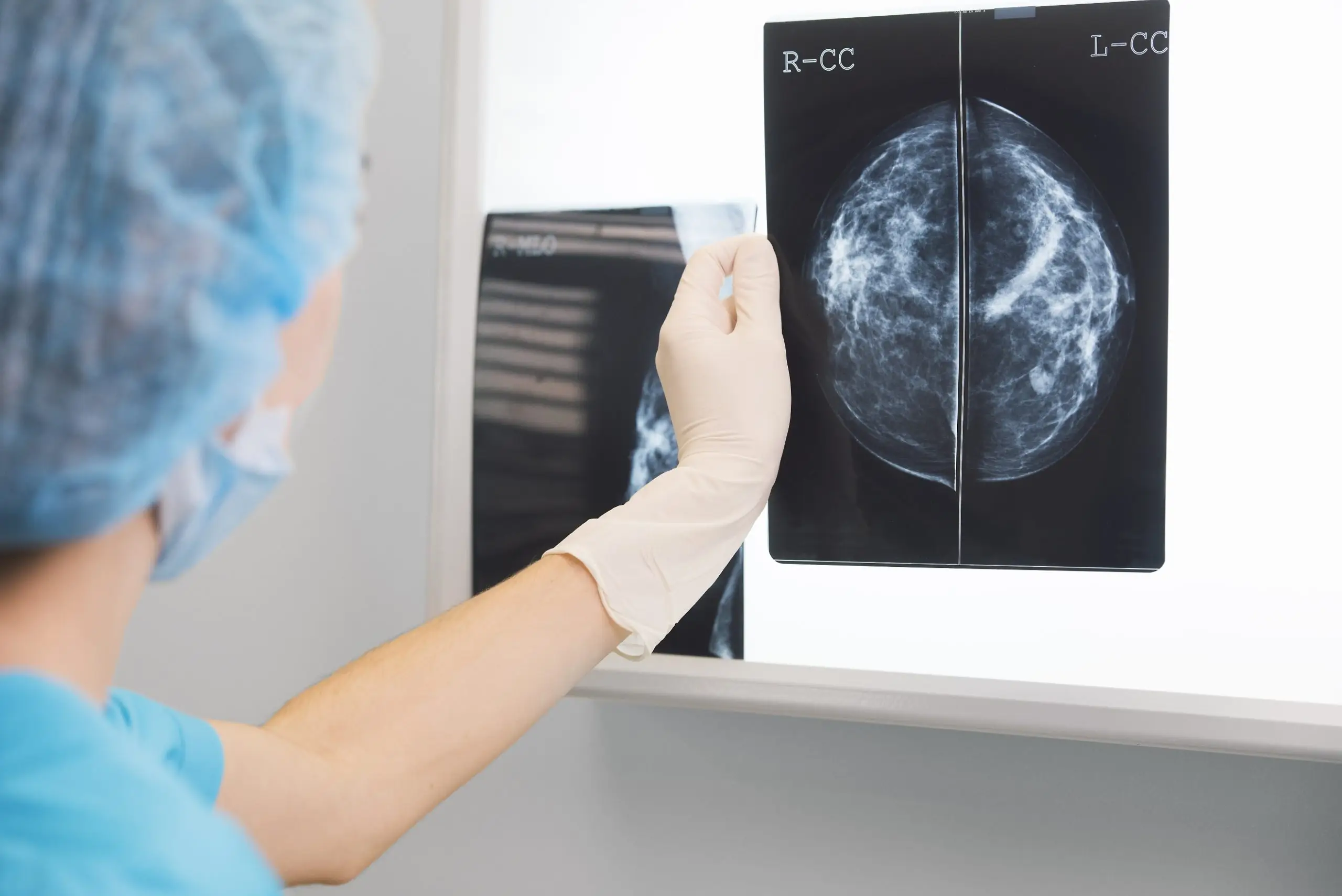 breast cancer disease definition scaled