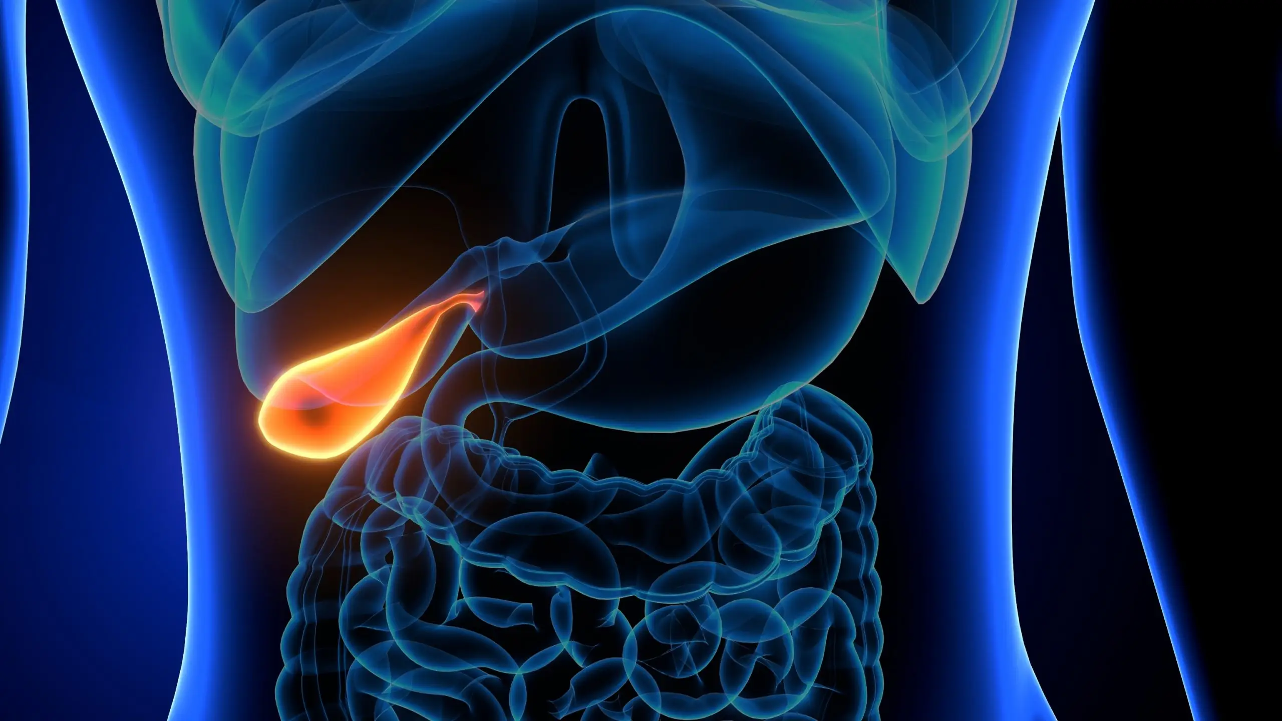 gallstones disease definition scaled