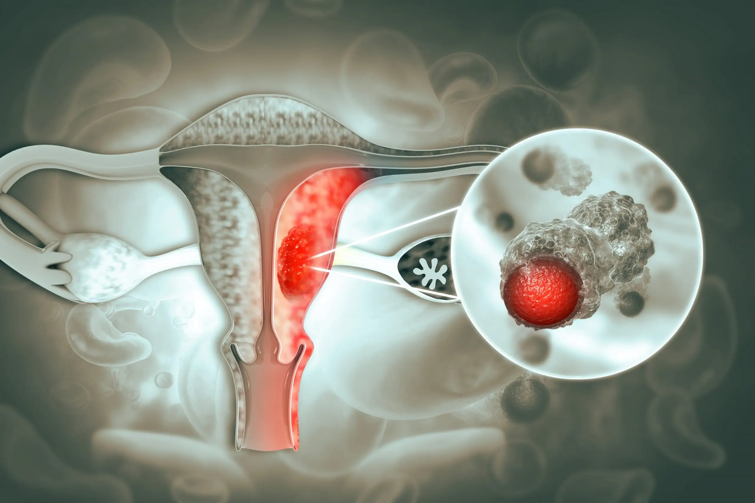 question endometrial cancer screening faq scaled