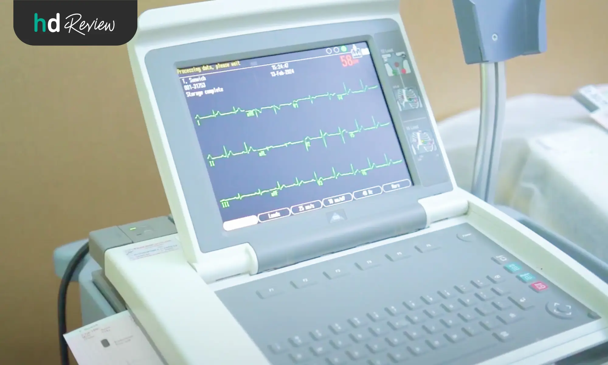 ตรวจคลื่นไฟฟ้าหัวใจ EKG