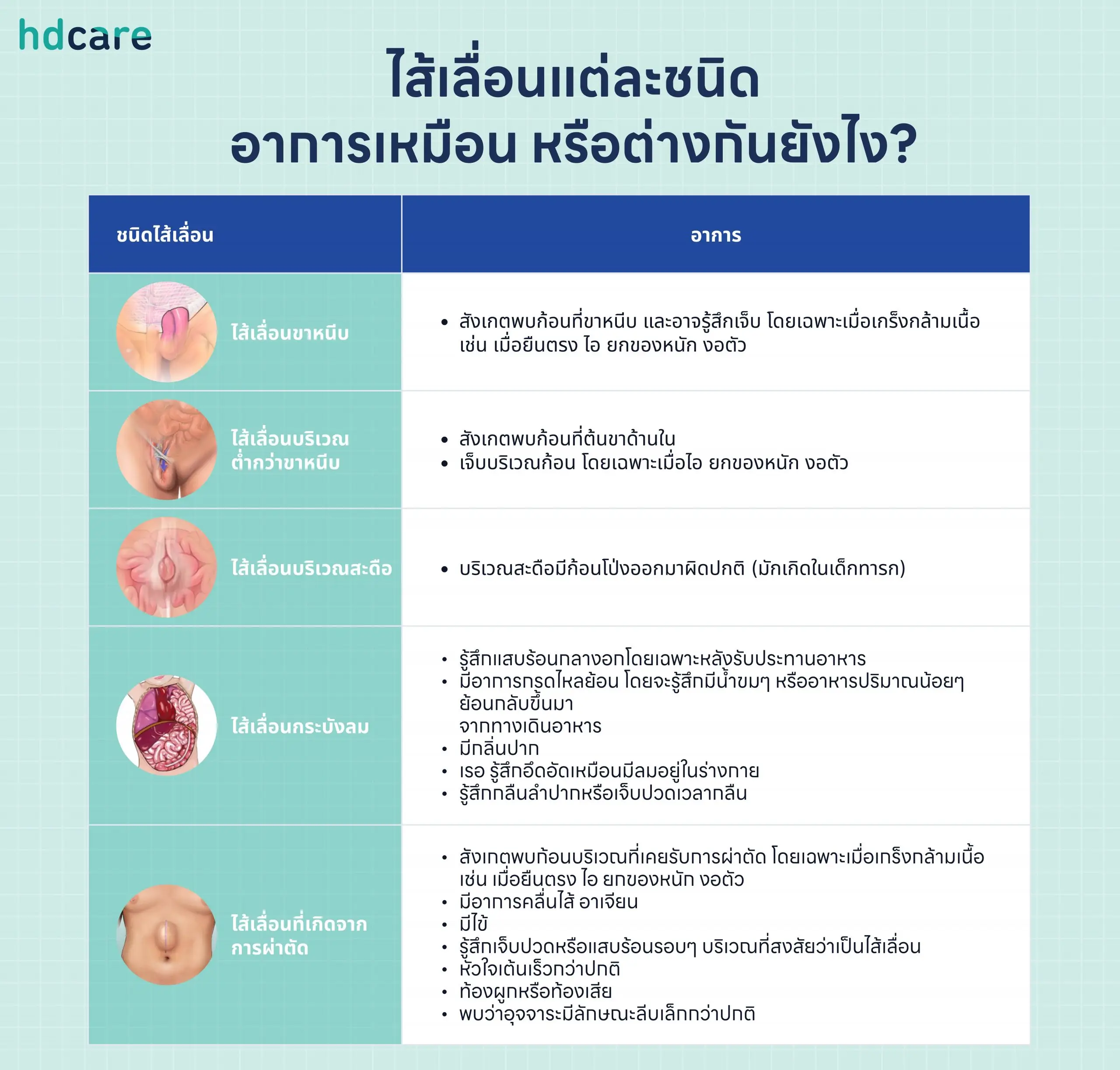 ไส้เลื่อนแต่ละชนิด อาการเหมือน หรือต่างกันยังไง