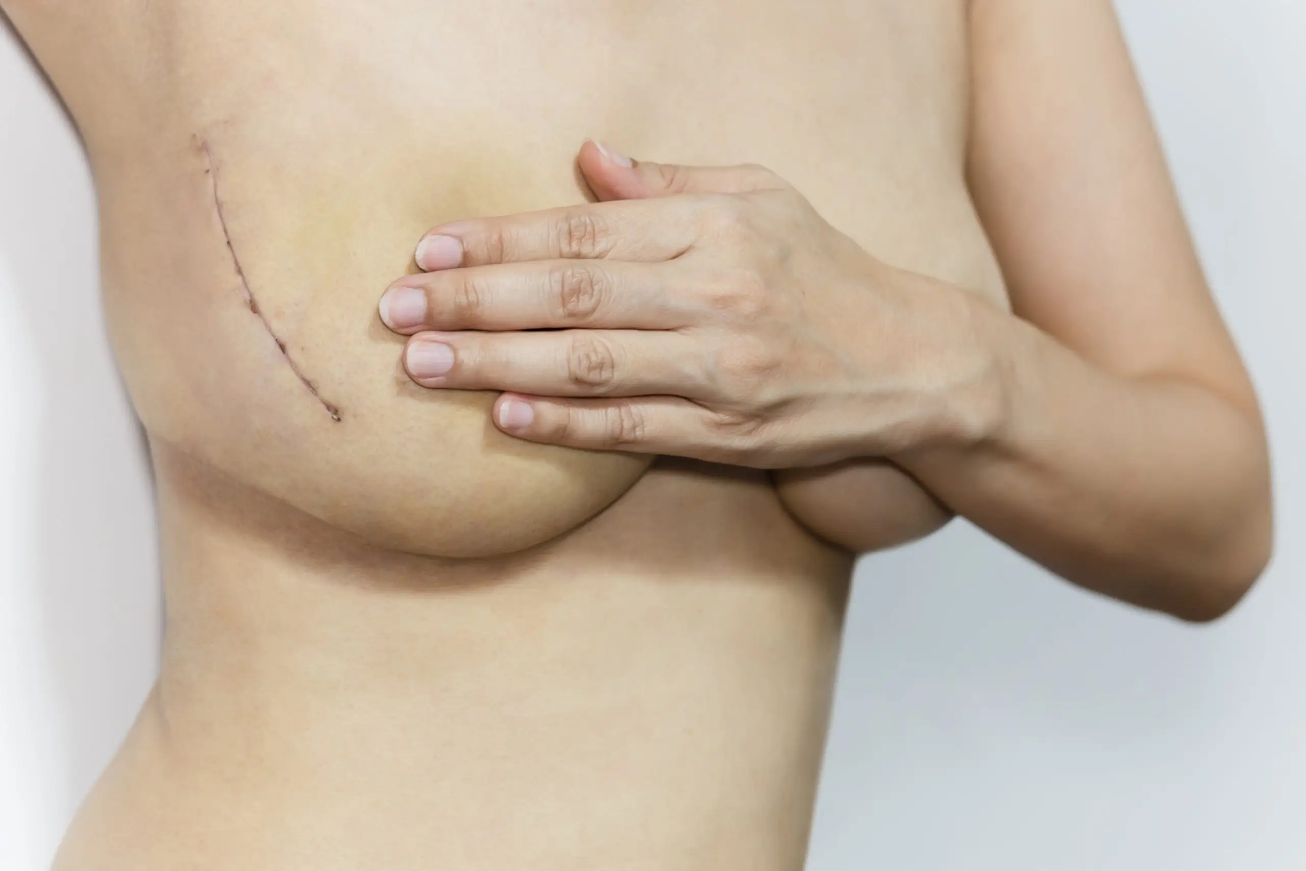 breast surgery treatment comparison scaled