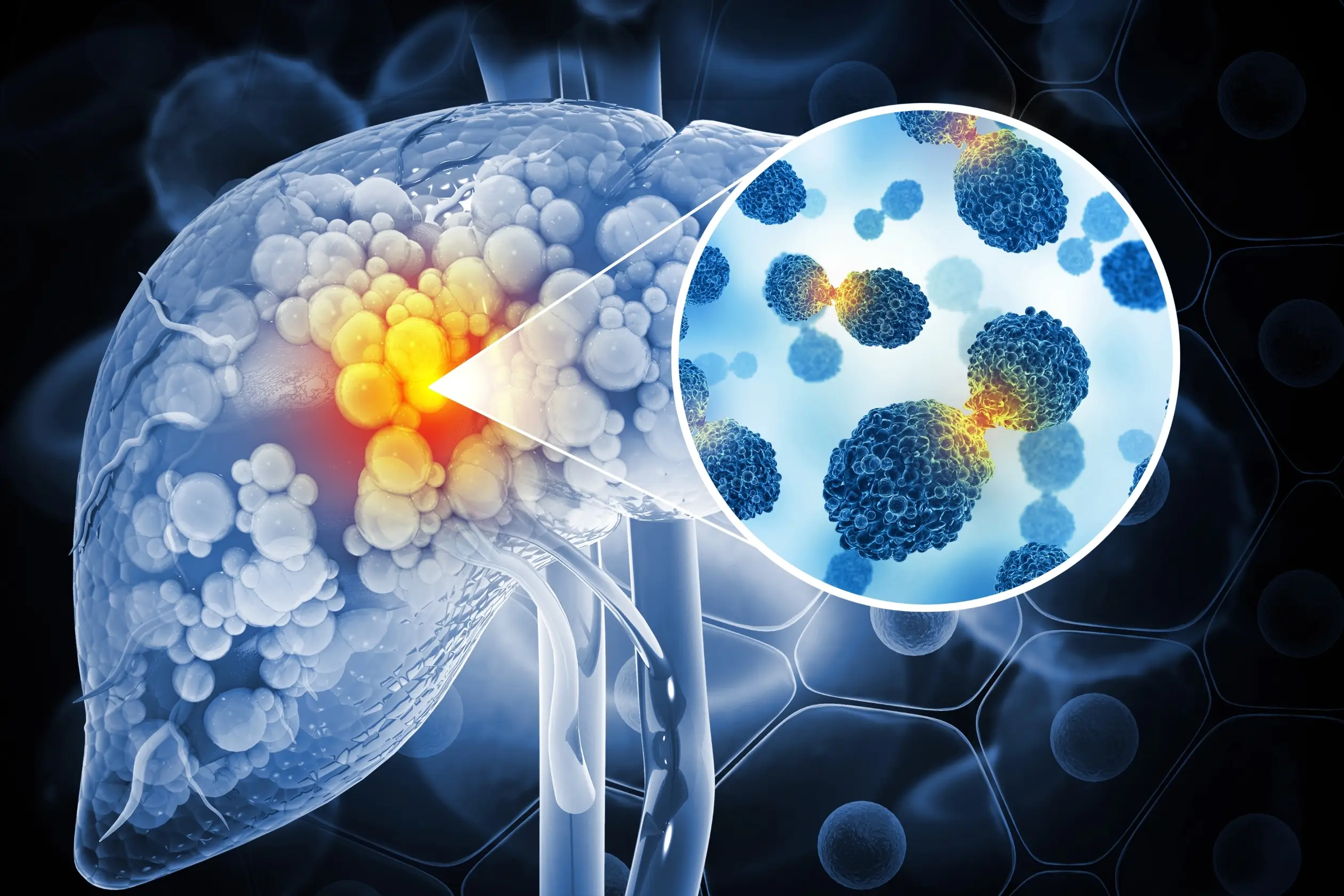 common types cancer in male screening when to get check