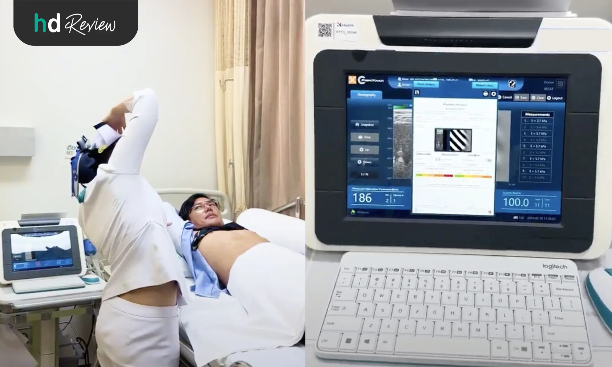 ขั้นตอนตรวจพังผืดตับ ด้วยเครื่อง Transient Elastography (TE)