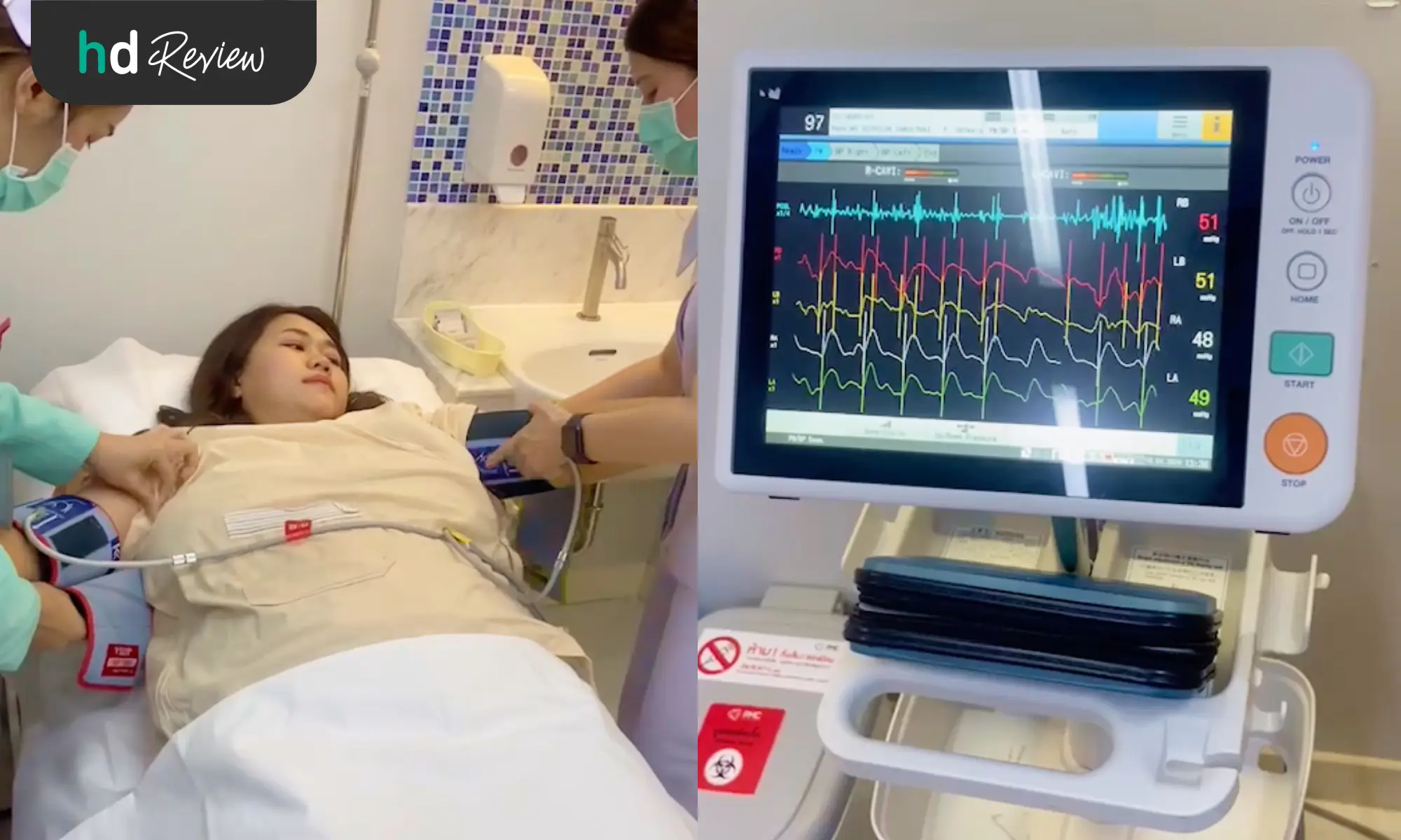 ขั้นตอนตรวจคลื่นไฟฟ้าหัวใจ EKG