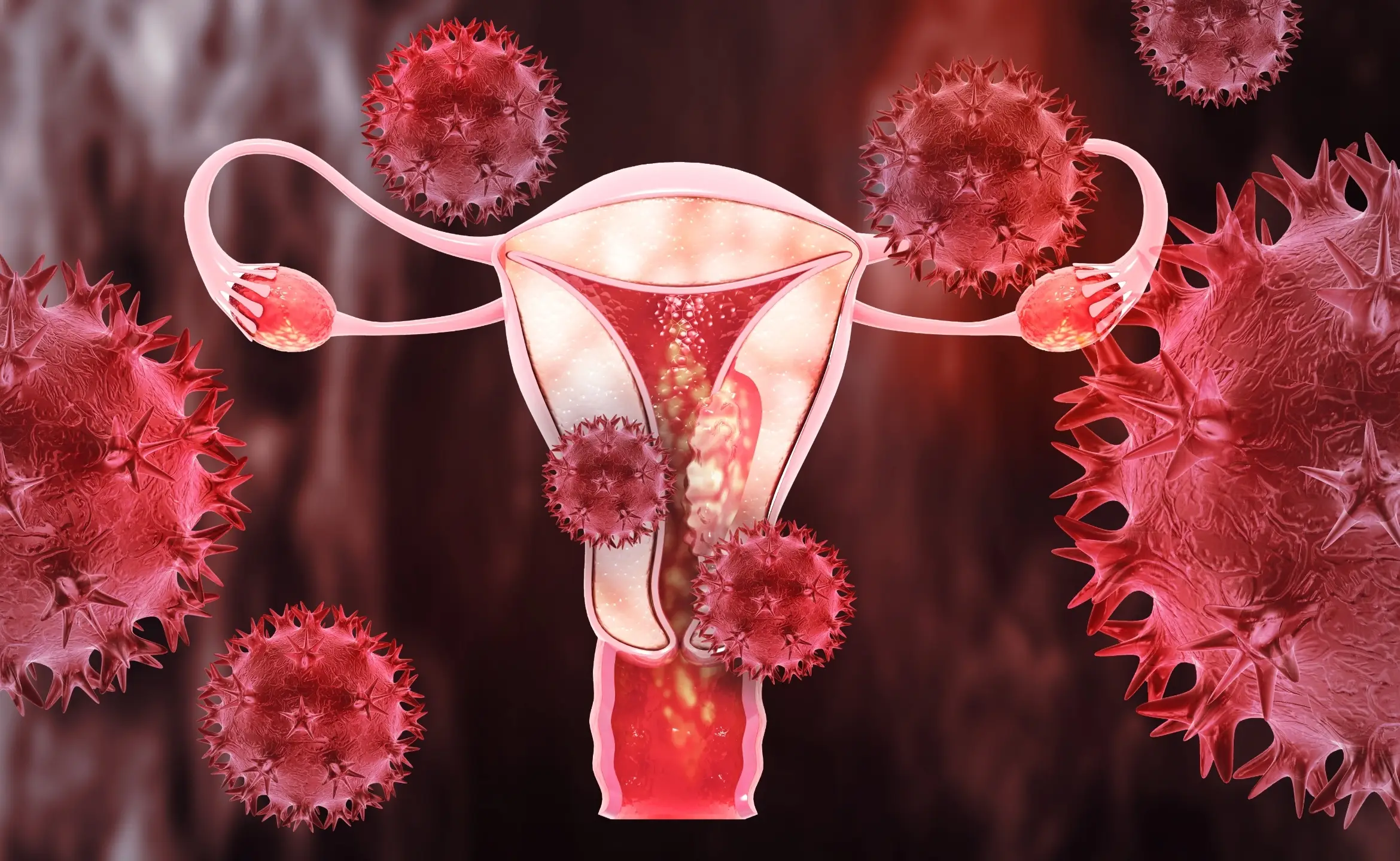 uterine fibroids cervical cancer uterine cancer disease faq