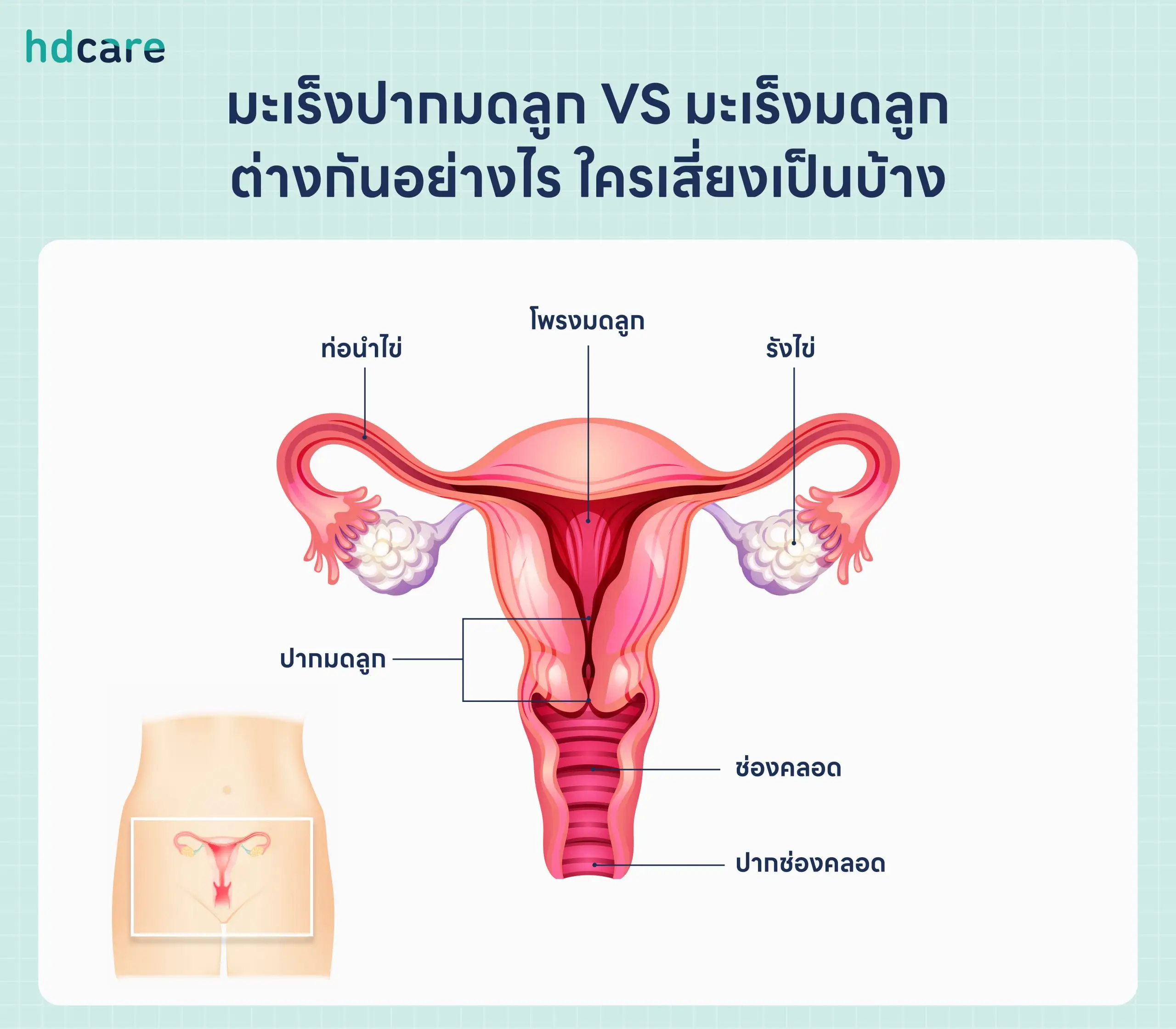 มะเร็งปากมดลูก VS มะเร็งมดลูก ต่างกันอย่างไร