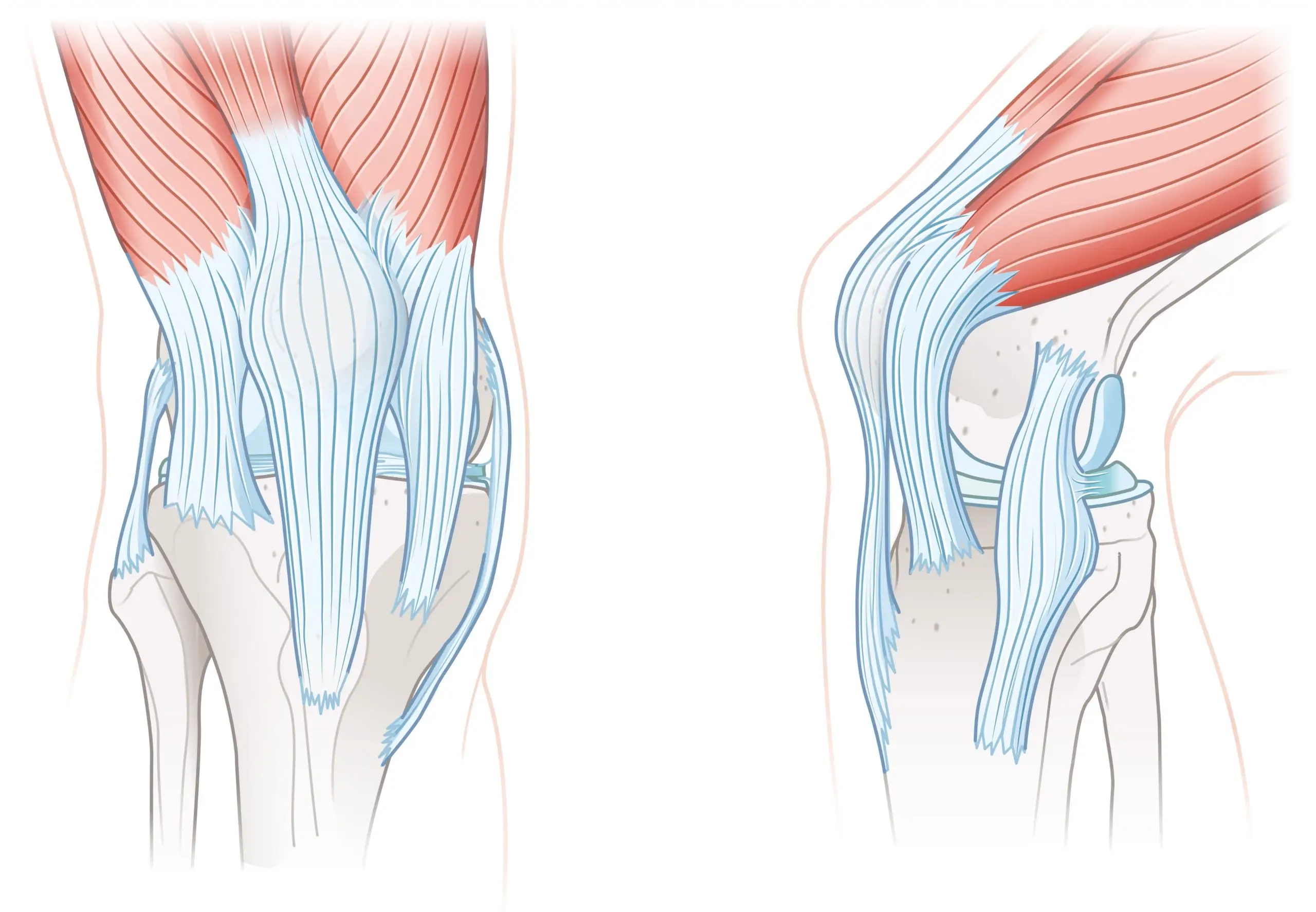 acl pcl disease definition scaled