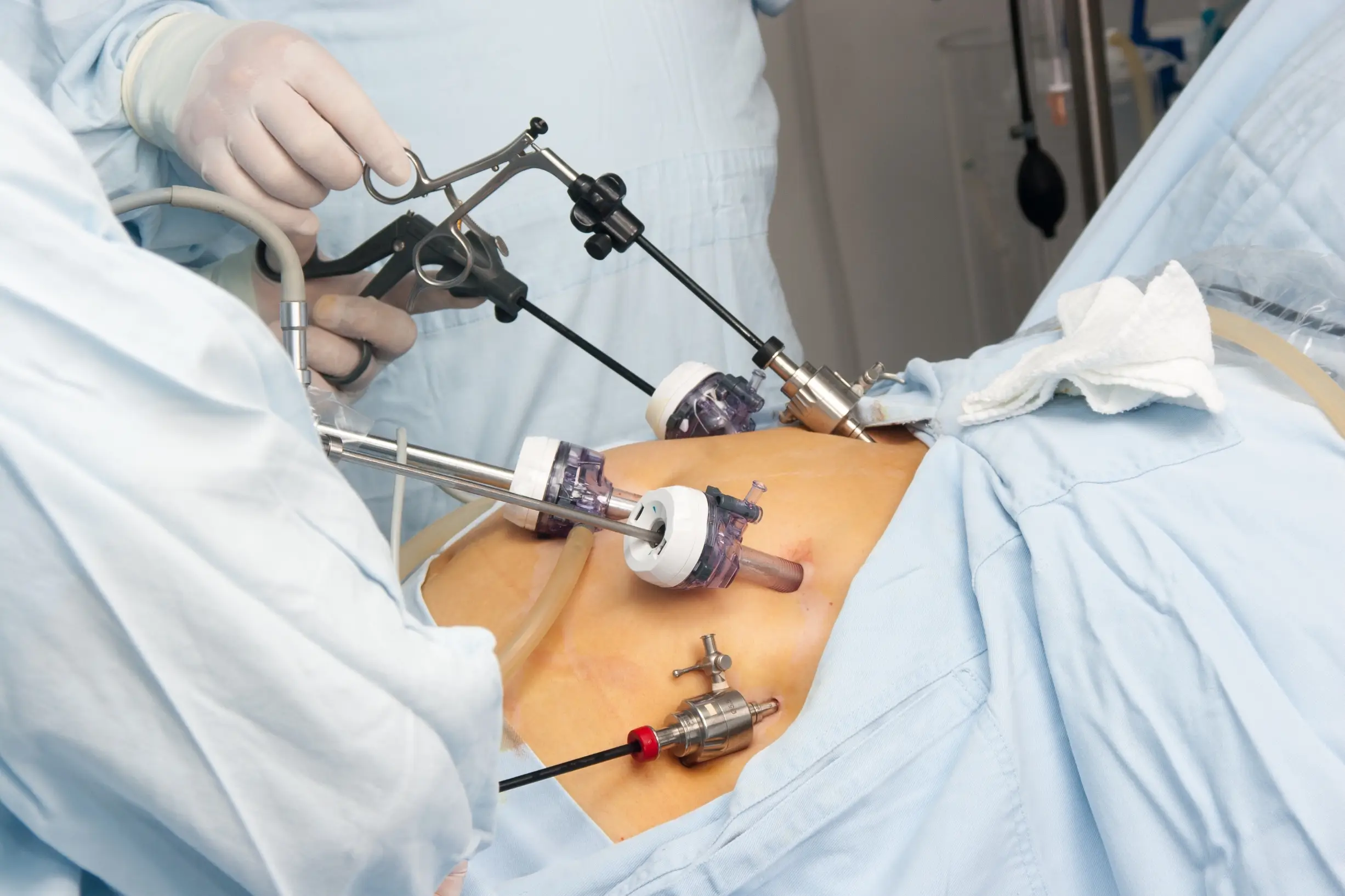 bariatric surgery treatment faq